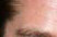 x_brow.jpg